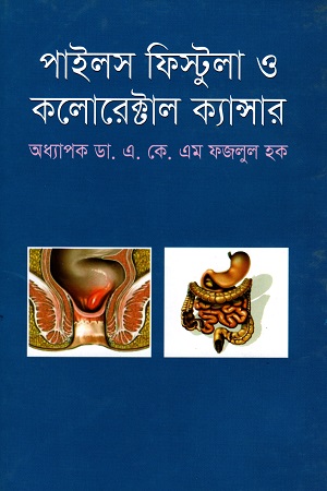 পাইলস ফিস্টুলা ও কলোরেক্টাল ক্যান্সার