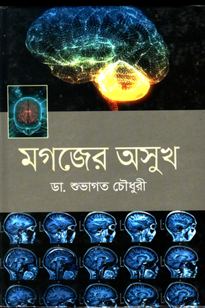 [9789842109218] মগজের অসুখ