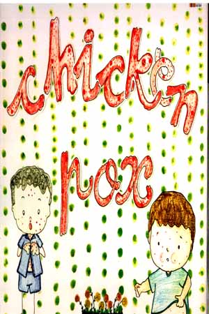 [9789386038623] Chicken Pox